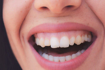 Closeup shot of human female face. Woman with pink lips and healthy dentes. Girl is smiling - obrazy, fototapety, plakaty