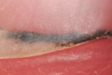 Dirt stuck under the man nail super macro