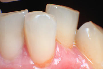 European male crooked yellow teeth super macro