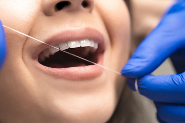dentist in blue medical gloves cleaning woman patient's teeth using dental floss in clinic close up