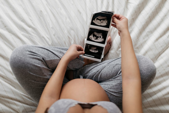 Young Pregnant Woman with Ultrasound photos