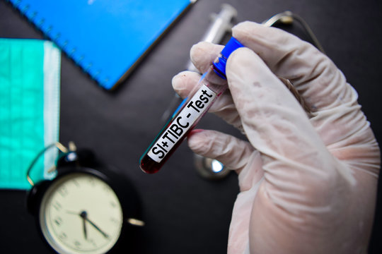 SI+TIBC - Test with blood sample. Top view isolated on black background. Healthcare/Medical concept