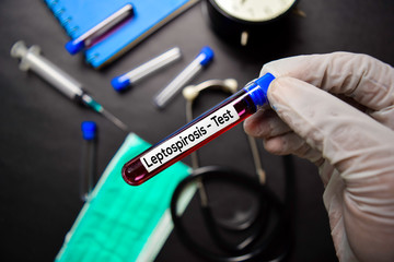 Leptospirosis - Test with blood sample. Top view isolated on black background. Healthcare/Medical concept