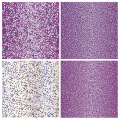 Fototapeta premium set of glittering vector background