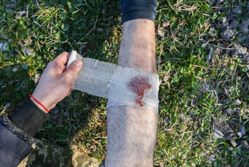 Man is putting bandage on bleeding wound. Injured leg. Tourist in the nature. Infection danger....