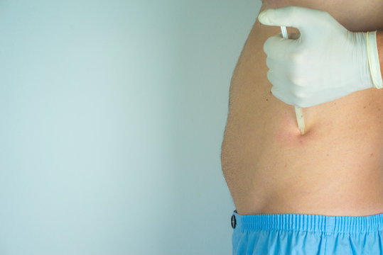 man with surgery pants, siringe in a hand with glove taking off the fat, white background