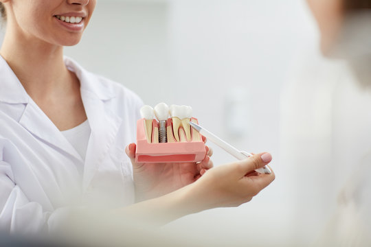 Closeup of smiling female dentist pointing at tooth model while consulting patient in clinic, copy space