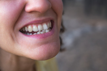 Photo of crooked woman teeth