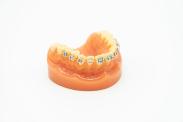 Denture model for medical education Patch concept and education. White background as background health  concept with copy space.