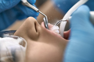 Pretty woman's teeth cleaning in dental clinic