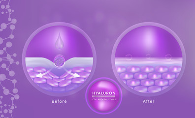 Hyaluronic acid before and after skin solutions ad, purple collagen serum drop with cosmetic advertising background ready to use, illustration vector.