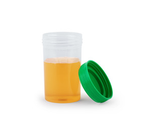 Medical urine test on white background