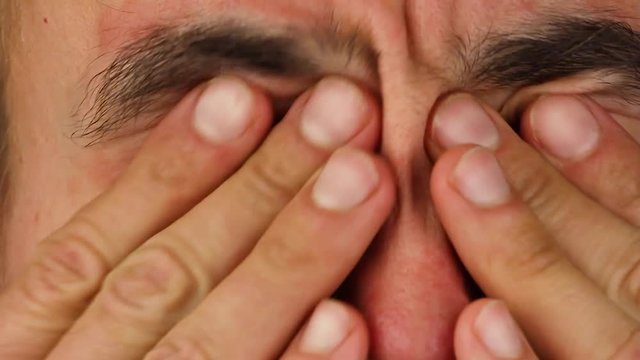 human scratches  two of his eyes with red allergic reaction, redness and peeling psoriasis on face skin, seasonal dermatology problem, close-up  