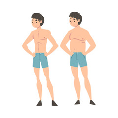 Young Man in Underwear Before and After Weight Loss, Male Body Changing Through Healthy Nutrition or Sports Vector Illustration
