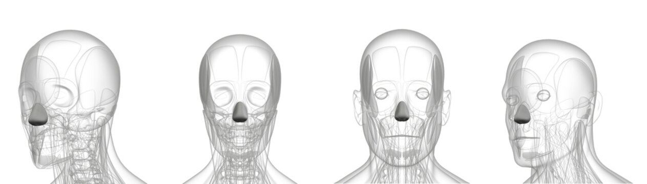3d rendering medical illustration of metal dilator naris