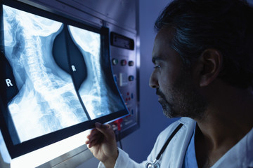 Mature male doctor examining x-ray on x-ray light box in operation room at hospital