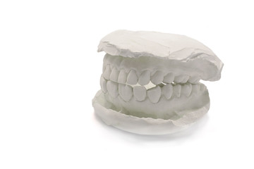 Dental model plaster on white background,isolated.Plaster model jaw with artificial dental designs with clipping path