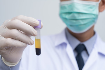 Doctor looking sample blood tube