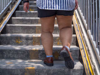 fat woman leg to step up the stairs