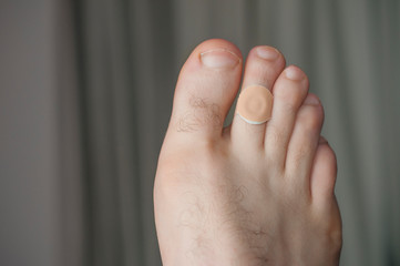 A man feet with corn remover pad on the second finger