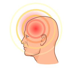 Head pain