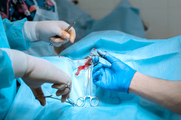 A male surgeon in a mask operates in a operating room with an assistant and an...