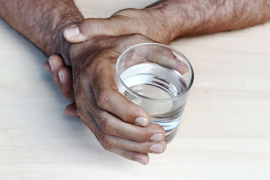 Einem Mann mit Parkinson zittern die H&auml;nde. Stark zitternde H&auml;nde von einem &auml;lteren Mann