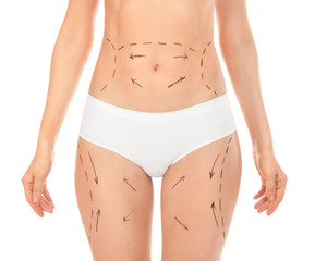 Fototapeta na wymiar Woman with marks on body for cosmetic surgery operation against white background, closeup