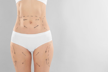 Woman with marks on body for cosmetic surgery operation against grey background, closeup