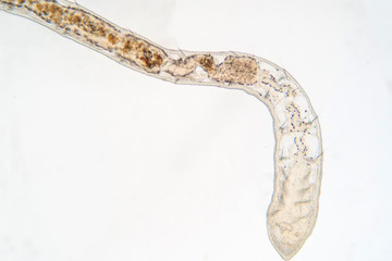 Tubifex worm under microscope view for education.