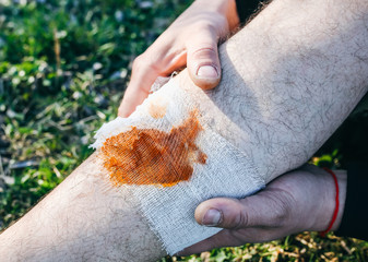 Man is putting bandage on bleeding wound. Injured leg. Tourist in the nature. Infection danger....
