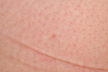 human skin texture