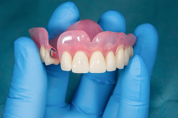 Close-up human denture of the upper jaw on a blue background in the hand of a dentist wearing a...
