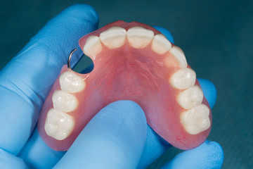 Close-up human denture of the upper jaw on a blue background in the hand of a dentist wearing a medical glove