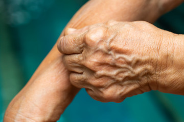 Senior Woman's left hand pinching her right arm, Blue swimming pool background, Close up shot, Asian Body skin part, Healthcare concept