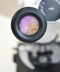 microscopic view of gonorrhea Neisseria gonorrhoeae. Selective focus on the eyepiece.