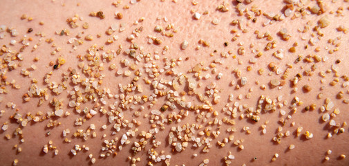 Sand on human skin