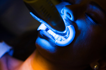 Face of a woman in a dental clinic doing teeth whitening