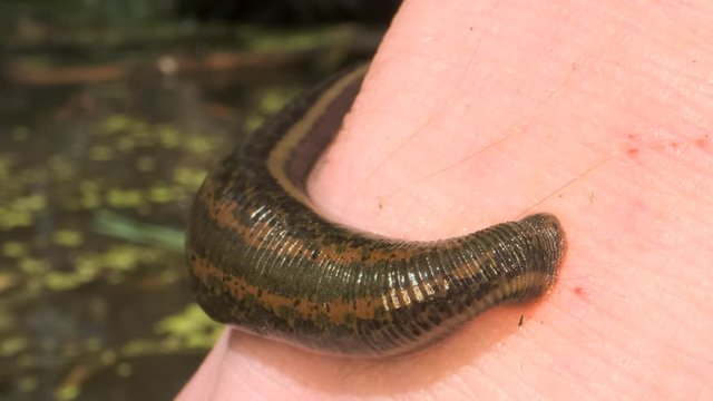 European leech are sucking blood from a foot in the natural habitat. Natural leech therapy. Close-up 