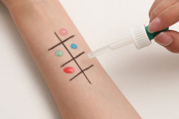 Patient undergoing skin allergy test at light table, closeup