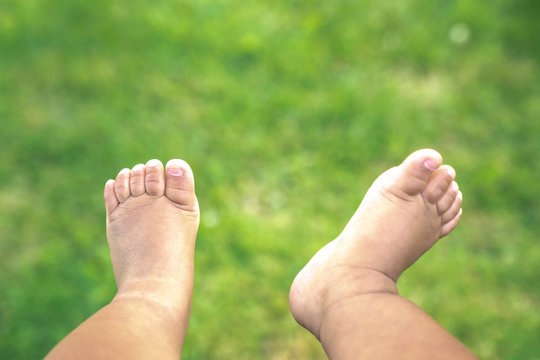 A Close Up Of Cute Or Adorable, Bare Skin Chubby Legs, Feet And Toes Of A Mixed Race Baby Boy Infant Hanging Down Over Lush Green Grass At A Park On A Sunny Summer Day.