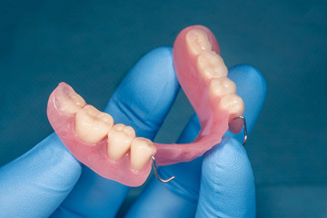Close-up human denture of the upper jaw on a blue background in the hand of a dentist wearing a...