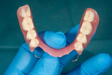 Close-up human denture of the upper jaw on a blue background in the hand of dentist wearing a medical a glove