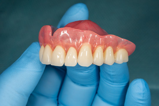 Close-up human denture of the upper jaw on a blue background in the hand of a dentist wearing a medical glove