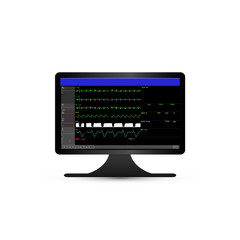 Computer monitoring and screen display of patient vital signs of intensive care unit in hospital.