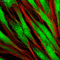 : Fibroblast cells. Confocal light micrograph of mammalian fibroblast cells. 