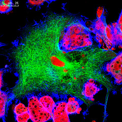 Real fluorescence microscopic view of mice neuroblastoma cell line - obrazy, fototapety, plakaty