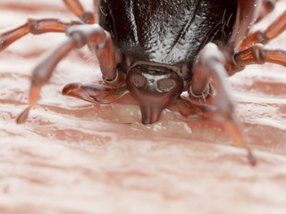 3d rendered illustration of a tick biting in human skin