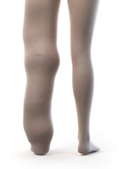 3d rendered medically accurate illustration of a lymphedema