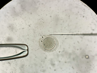View through microscope at in vitro fertilization process